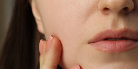 Deze dingen vermijd je best bij een gevoelige huid I Skincare Boulevard