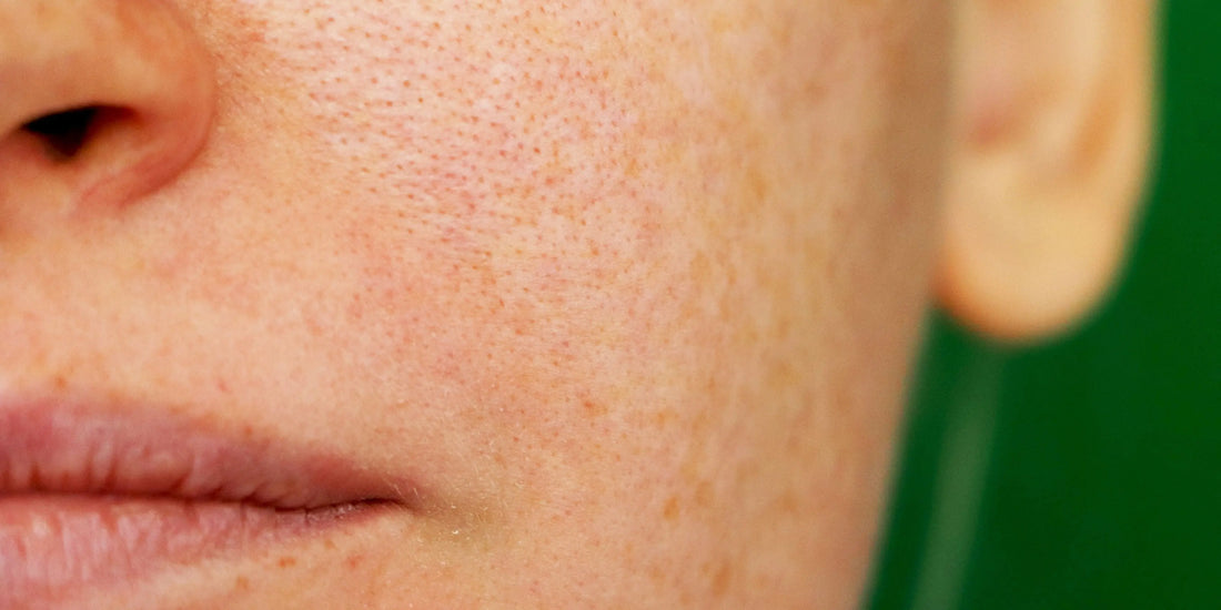 Hoe kan je grote poriën verminderen Skincare Boulevard