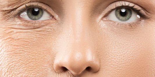 Hoe een peeling je huid opfrist en waarom iedereen een peeling zou moeten uitvoeren I Skincare Boulevard