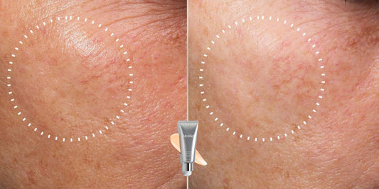 Retinal en de gevoelige huid | Tips om op te bouwen – Skincare Boulevard