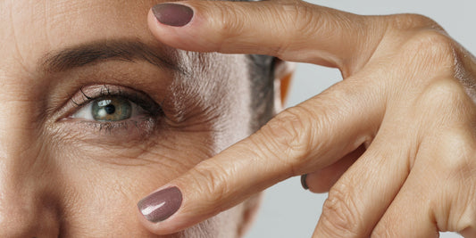 Is botox de oplossing voor rimpels aan het oog? In deze blog vind je andere oplossingen I Skincare Boulevard