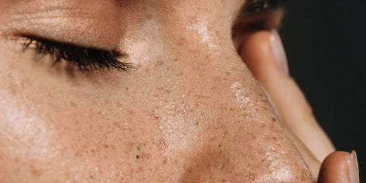 Verbeter je huid met hyaluronzuur: minder rimpels gladde huid Skincare Boulevard