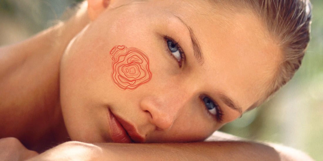 Wat is couperose I Skincare Boulevard