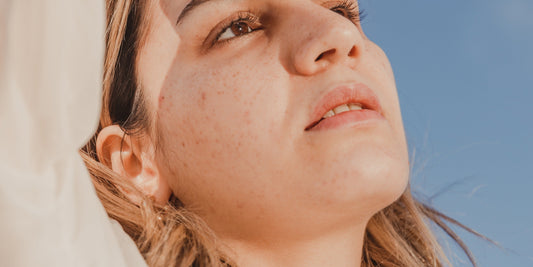 Onzuivere huid? Tips om je huid te verbeteren | Skincare Boulevard