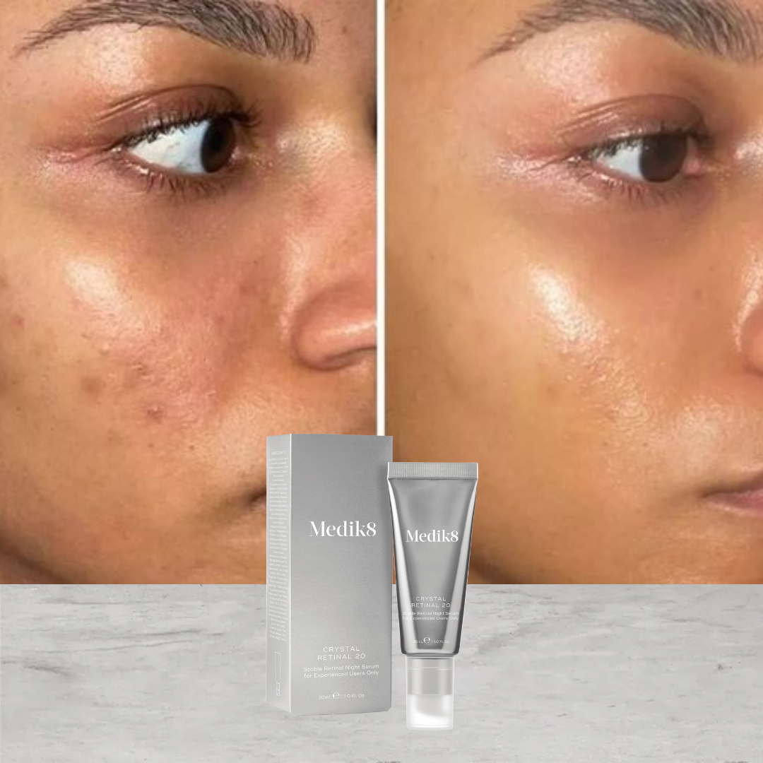 Crystal Retinal 20