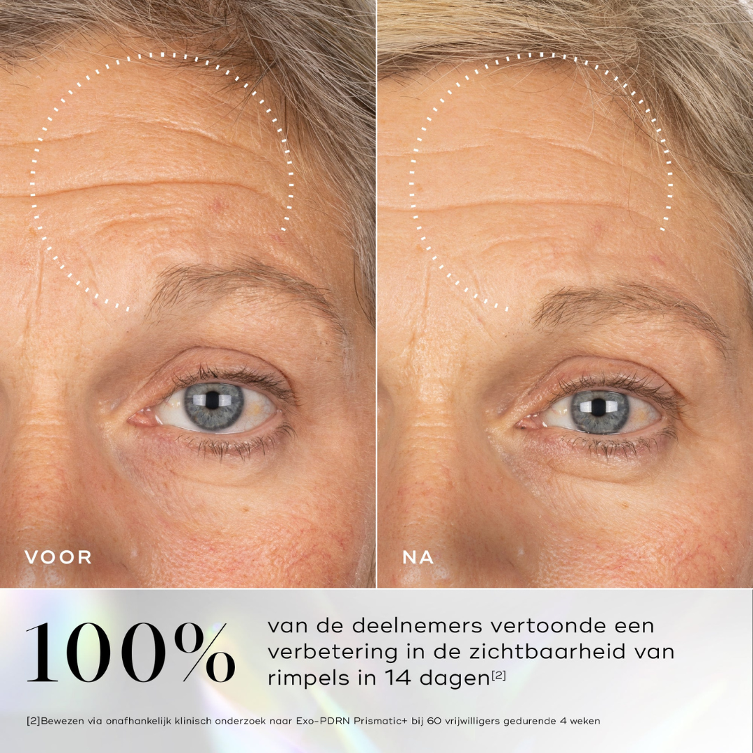 Voor en na resultaat van huidverjonging met Medik8 Exo-PDRN Prismatic serum
