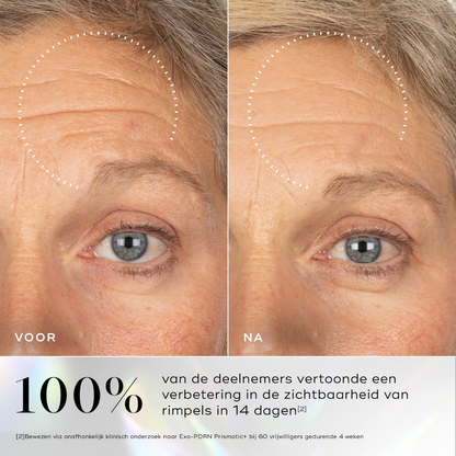 Voor en na resultaat van huidverjonging met Medik8 Exo-PDRN Prismatic serum