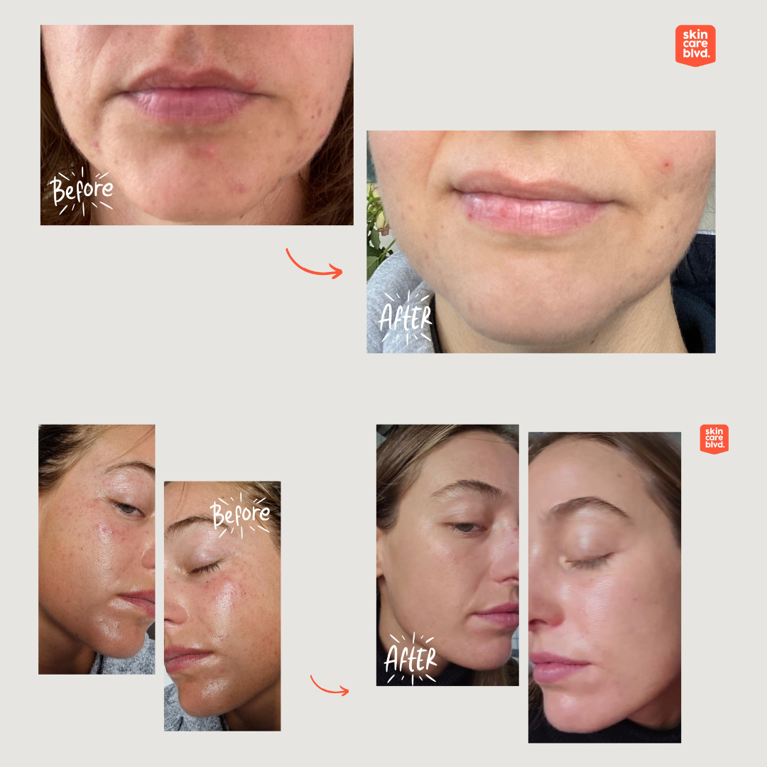 Synbiotic Skin Spray met Probiotica 200 ml